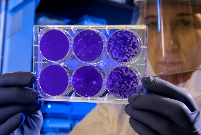 Resistência de superbactérias a antibióticos comuns faz OMS emitir alerta