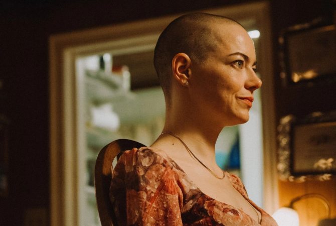 Emma Stone fica careca e pre-estreia de filme é exclusiva para quem raspar a cabeça