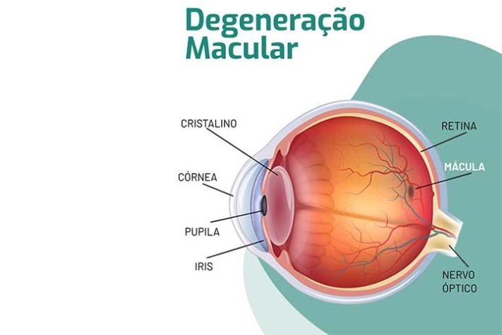 Degeneração macular