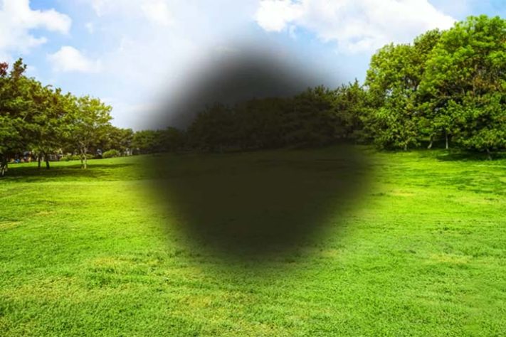 Degeneração macular