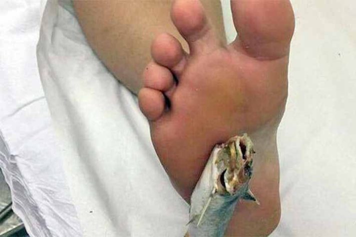 Curiosidades e cuidados com o bagre