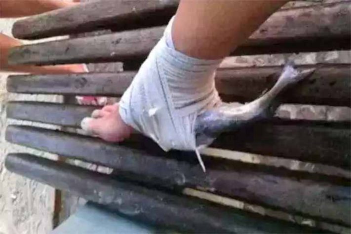 Curiosidades e cuidados com o bagre