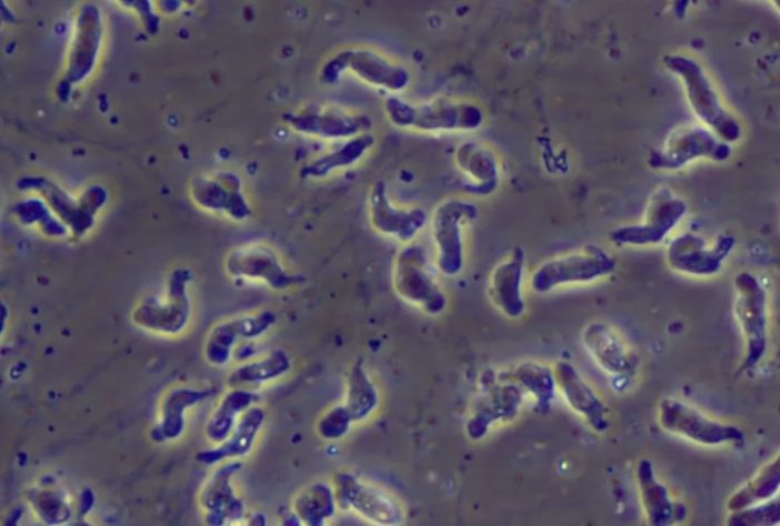 Naegleria fowleri é conhecida como 'ameba comedora de cérebro' – Reprodução/CDC