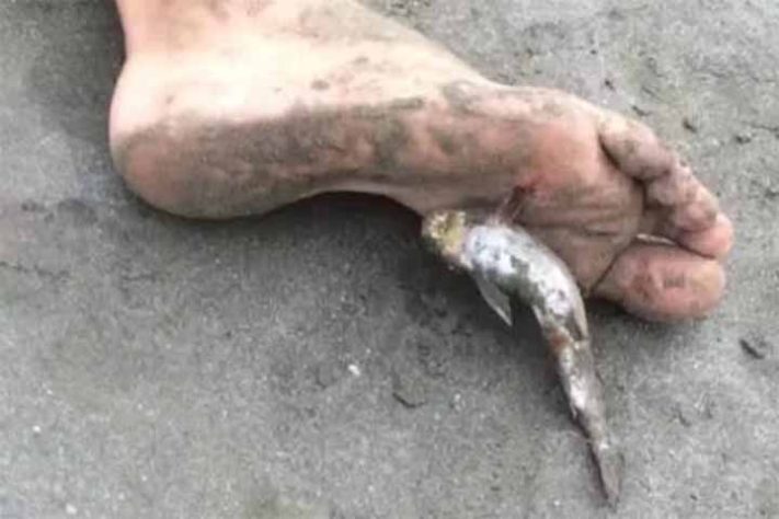 Curiosidades e cuidados com o bagre