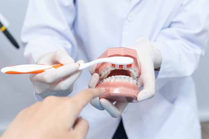 História da escova de dentes e os hábitos saudáveis da higiene bucal