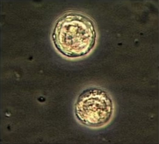 Amebas mortais se espalham pelo mundo e ligam alerta de cientistas – Divulgação/CDC