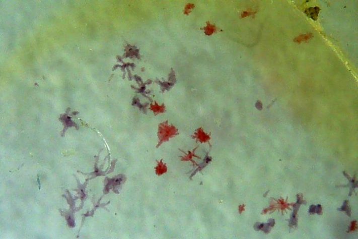 Amebas – Wikimedia Commons/The Other 95%