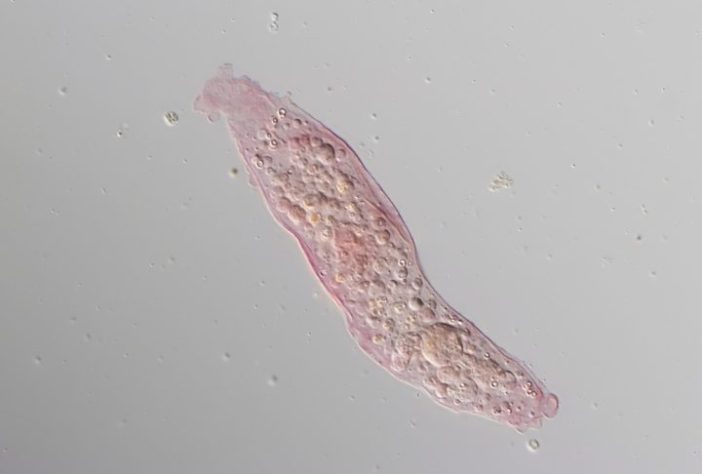 Amebas mortais se espalham pelo mundo e ligam alerta de cientistas – Wikimedia Commons/Dalinda Bouraoui