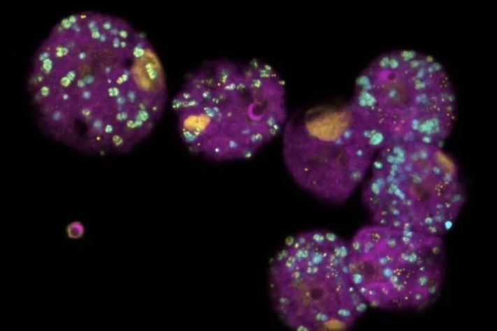Naegleria fowleri é conhecida como 'ameba comedora de cérebro' –Divulgação/Patrick Arthofer