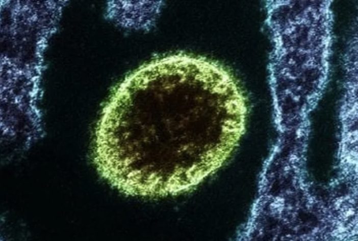 Vírus Nipah – Reprodução/Instituto Nacional de Alergia e Doenças Infecciosas dos EUA