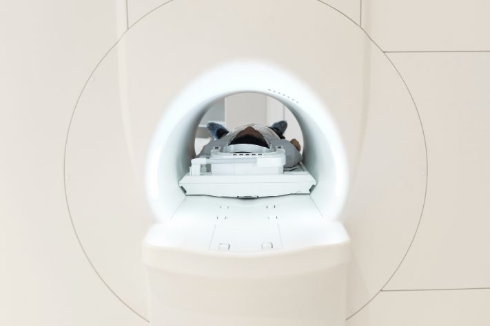 Tomografia Computadorizada – Reprodução/Freepik