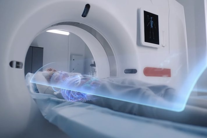 China desenvolve equipamento de tomografia que pode revolucionar o diagnóstico precoce do câncer – Divulgação/Nanovision