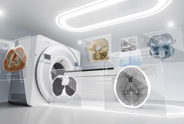 China desenvolve equipamento de tomografia que pode revolucionar o diagnóstico precoce do câncer – Divulgação/Nanovision