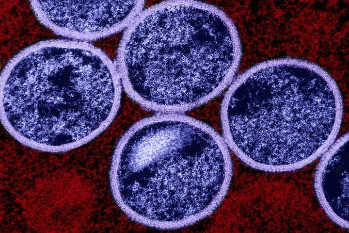 <p>A mpox é uma doença infecciosa zoonótica causada por um vírus da mesma família da varíola.</p>
