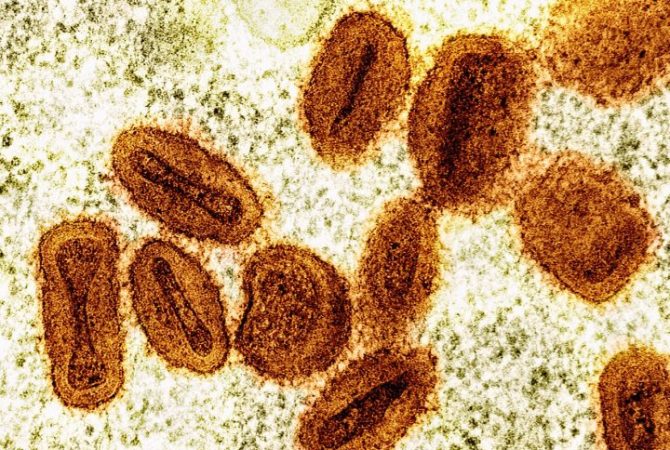 Nova variante e aumento de casos no Brasil: veja o que se sabe até agora sobre o vírus mpox