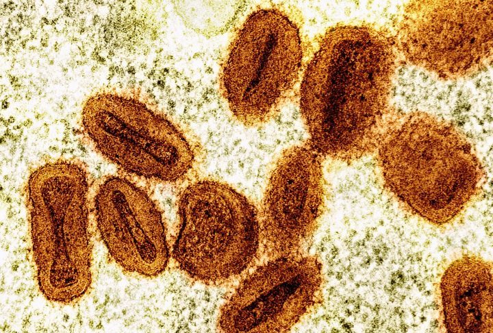 Mpox – Reprodução/NIAID