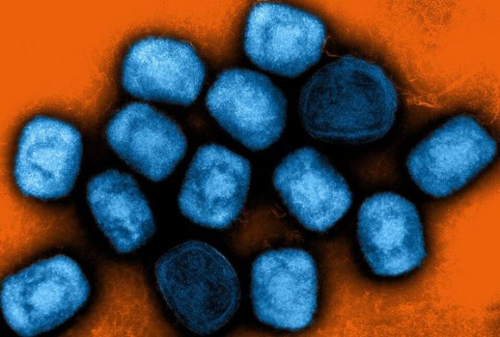 Vírus Mpox | Flickr - NIAID