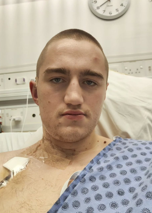 <p>ApÃ³s avaliaÃ§Ãµes, os mÃ©dicos confirmaram o diagnÃ³stico de melanoma maligno, e exames adicionais apontaram que o cÃ¢ncer havia se espalhado para o pescoÃ§o. Em fevereiro de 2022, ele passou por uma cirurgia de 12 horas para remover o tumor principal e 75 linfonodos do rosto e do pescoÃ§o, utilizando pele da coxa esquerda para reconstruÃ§Ã£o.</p>
