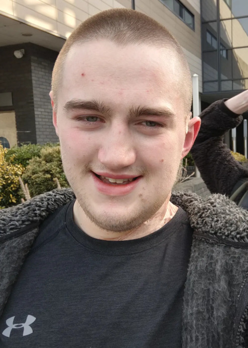 <p>Quando as medidas de lockdown foram flexibilizadas e ele finalmente retornou ao barbeiro, o profissional percebeu que a mancha atrás da orelha havia aumentado de tamanho de forma significativa. Diante disso, Finnian resolveu procurar um médico para averiguar o que estava acontecendo.</p>
