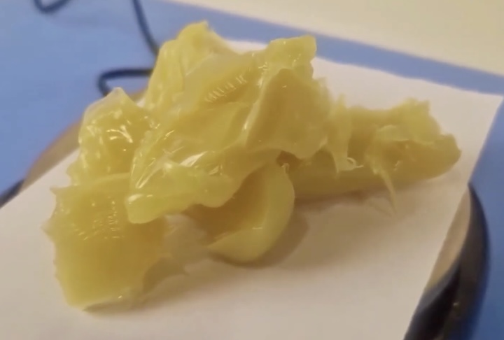 <p>Esse líquido é então filtrado e submetido a processos de separação e purificação que permitem extrair a lanolina em sua forma bruta, uma substância amarelada e de textura gordurosa.</p>
