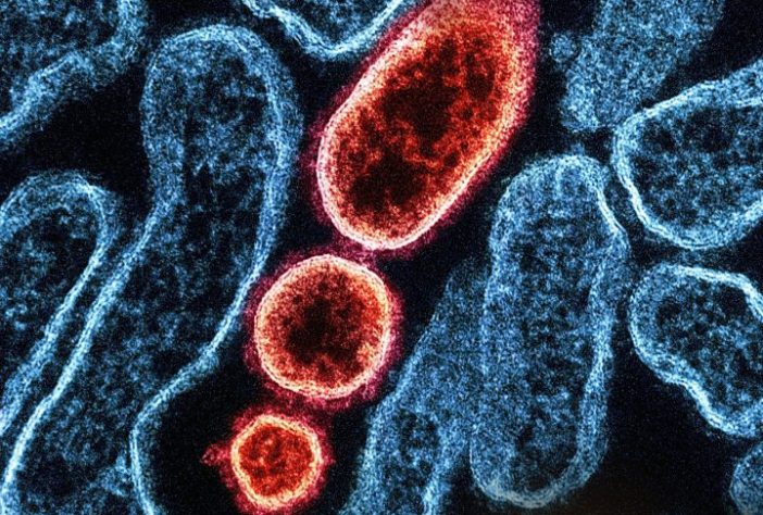 Microrganismos - Unsplash/National Institute of Allergy and Infectious Diseases