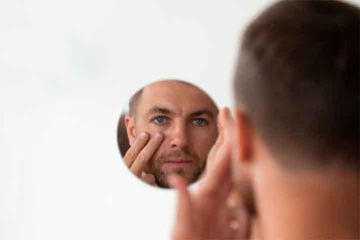 Como tirar ciscos do olho com segurança