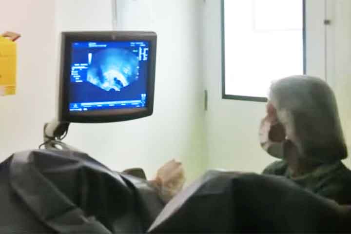 Nos anos seguintes, a fertilização in vitro consolidou-se internacionalmente, com novos nascimentos e o aperfeiçoamento dos métodos laboratoriais e clínicos.
