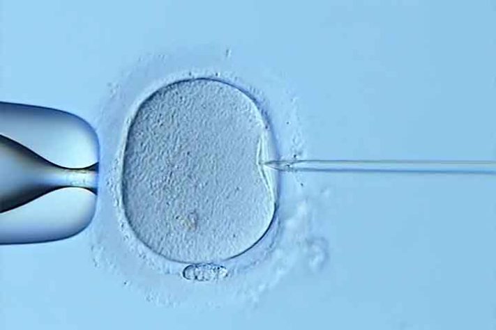 Fertilização in vitro