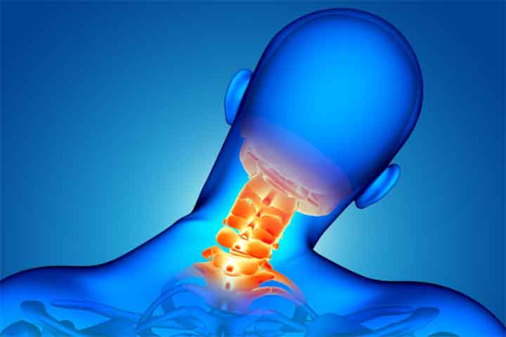 Em alguns casos, a neoplasia cervical pode estar associada a tumores de cabeça e pescoço, incluindo aqueles que afetam a garganta, a laringe ou a tireoide. A identificação da origem exata é essencial para determinar o tipo e a gravidade do quadro.
