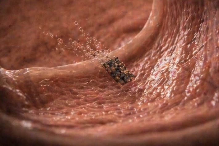 Pesquisadores dos Estados Unidos desenvolveram robôs microscópicos que tomam decisões e podem até 'nadar' dentro do corpo humano - Imagem gerada por IA