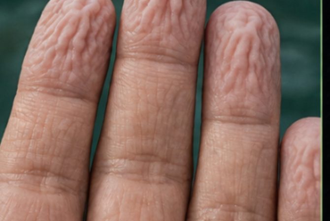 Por que os dedos ficam enrugados na água: o mecanismo do corpo que vai além da absorção e pode até melhorar a aderência