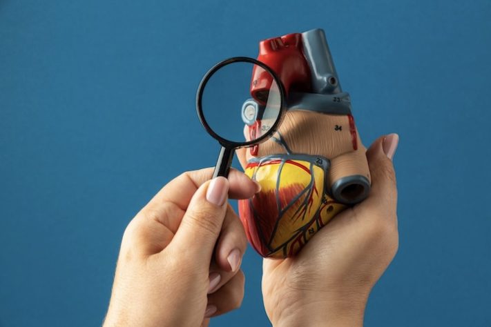 Colesterol, coração, doenças cardiovasculares - Reprodução/Freepik