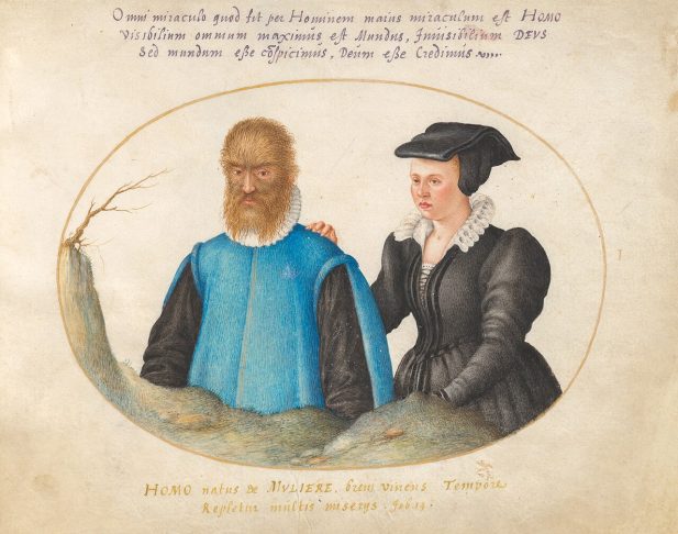Muitos estudiosos acreditam que a narrativa também se inspirou em casos reais, especialmente na história de Petrus Gonsalvus, um homem que sofria de hipertricose, condição rara que cobre o corpo de pelos. Ele viveu nas cortes europeias durante o Renascimento e acabou se casando com uma mulher considerada muito bonita na época.