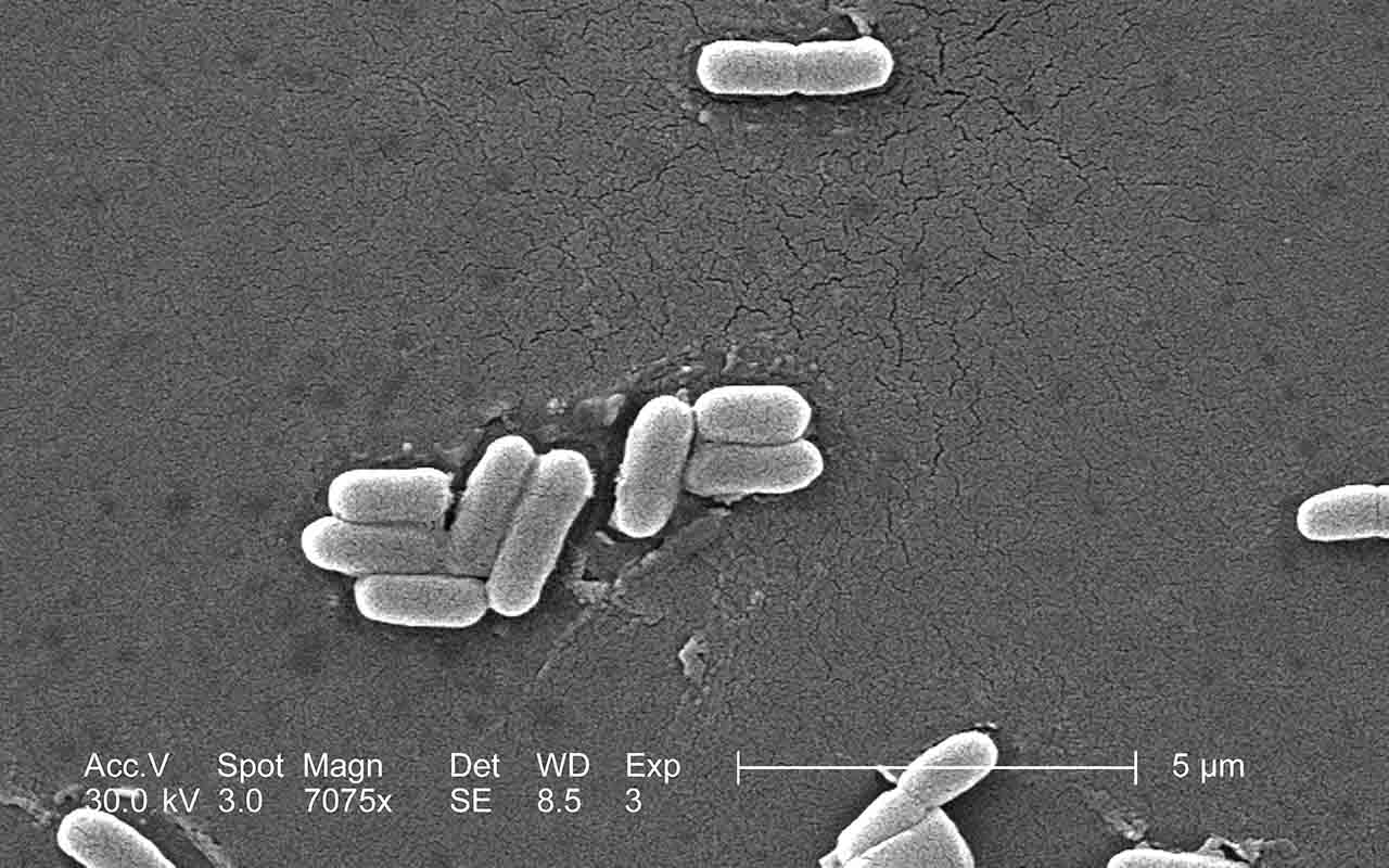 5 - Proteger contra a bactéria Helicobacter pylori: Com ação antimicrobiana e anti-inflamatória, o própolis pode ajudar no combate à Helicobacter pylori, bactéria associada à gastrite e úlceras. Seu uso pode aliviar sintomas e atuar como alternativa complementar no tratamento dessas condições.
