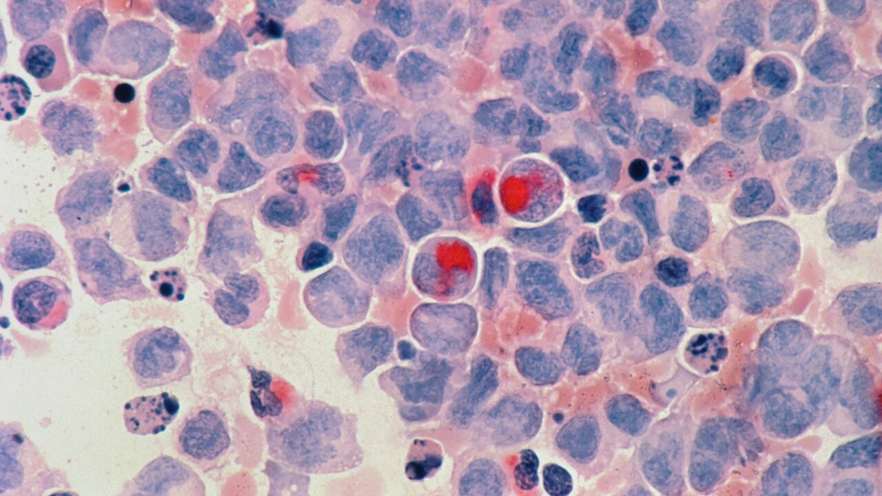 O teste utiliza anticorpos específicos para identificar sangue nas fezes, que pode estar relacionado a pólipos, lesões pré-cancerígenas ou ao câncer colorretal. Segundo dados apresentados pelo Ministério da Saúde, a capacidade de detecção do tumor chega a 92%. 
