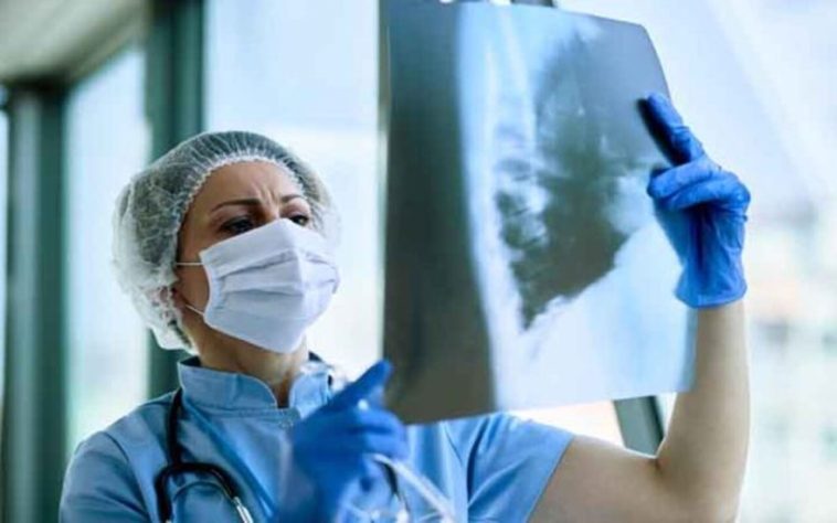 Tuberculose