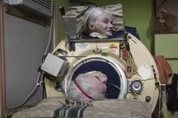 Após mais de 70 anos em 'pulmão de aço', morre Martha Ann Lillard, última paciente a utilizar o aparelho nos Estados Unidos – Reprodução/YouTube