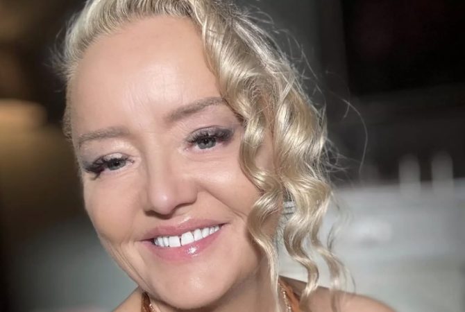 Atriz de ‘The Office’ e ‘Mulher-Maravilha’, Lucy Davis revela câncer de mama em estágio ‘incurável’
