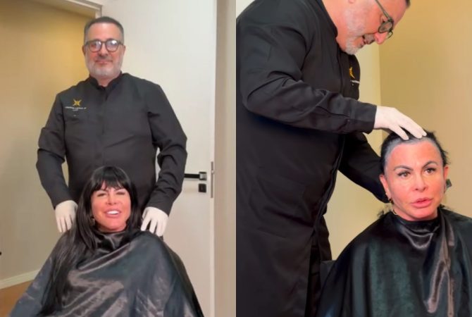 Gretchen raspa a cabeça em live antes de transplante capilar