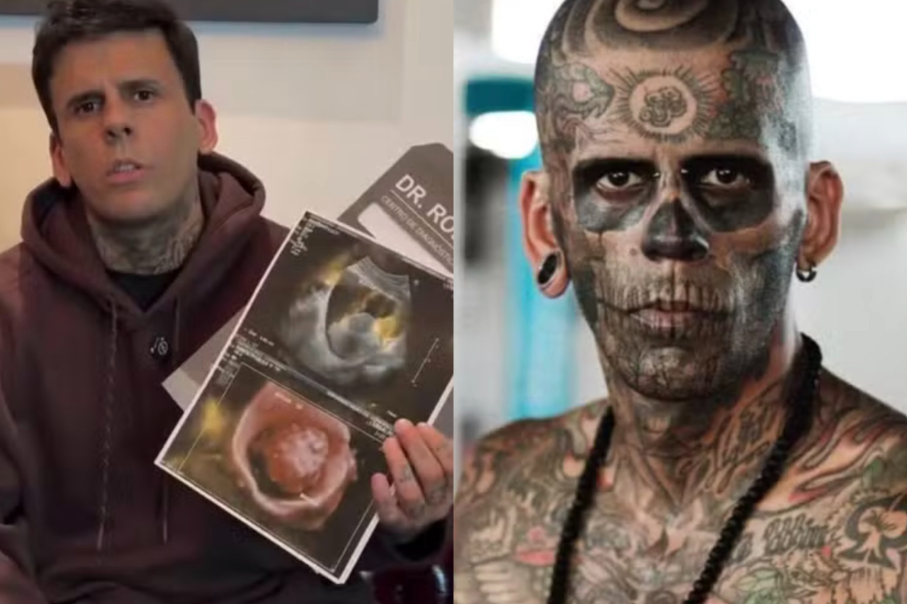 'Homem mais tatuado do Brasil', Leandro de Souza teve sessão de remoção adiada após descoberta de tumor – Reprodução/Redes Sociais/Arquivo Pessoal