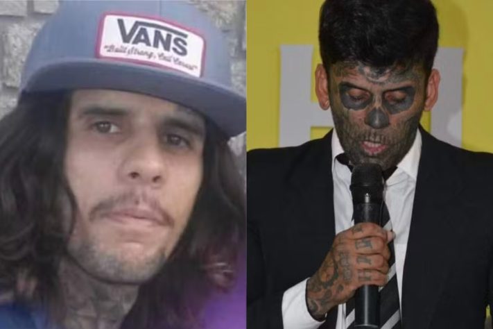 'Homem mais tatuado do Brasil', Leandro de Souza teve sessão de remoção adiada após descoberta de tumor – Arquivo Pessoal