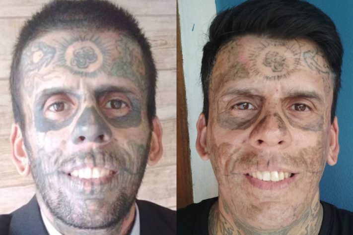 'Homem mais tatuado do Brasil', Leandro de Souza teve sessão de remoção adiada após descoberta de tumor – Reprodução/Redes Sociais