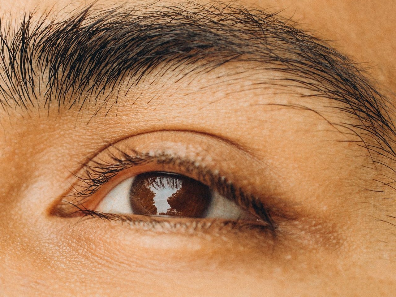 Além da estética, a cirurgia costuma ter indicação funcional. Em muitos casos, o excesso de pele na pálpebra superior pesa sobre os olhos e chega a atrapalhar a visão periférica do paciente. Os cortes são discretos, escondidos nas dobras naturais dos olhos ou por dentro da pálpebra, e a recuperação exige repouso com compressas frias. 
