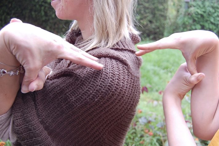 Síndrome de Ehlers-Danlos – Wikimedia Commons/Lucyin