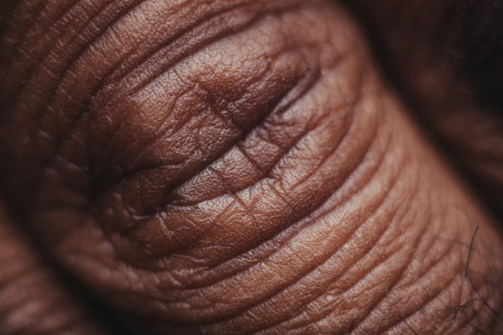 Pele humana – Nsey Benajah/Unsplash