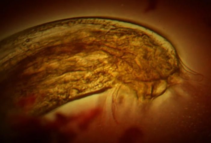 Parasita Angiostrongylus cantonensis