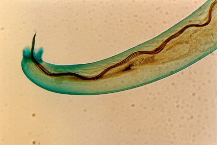 Parasita Angiostrongylus cantonensis